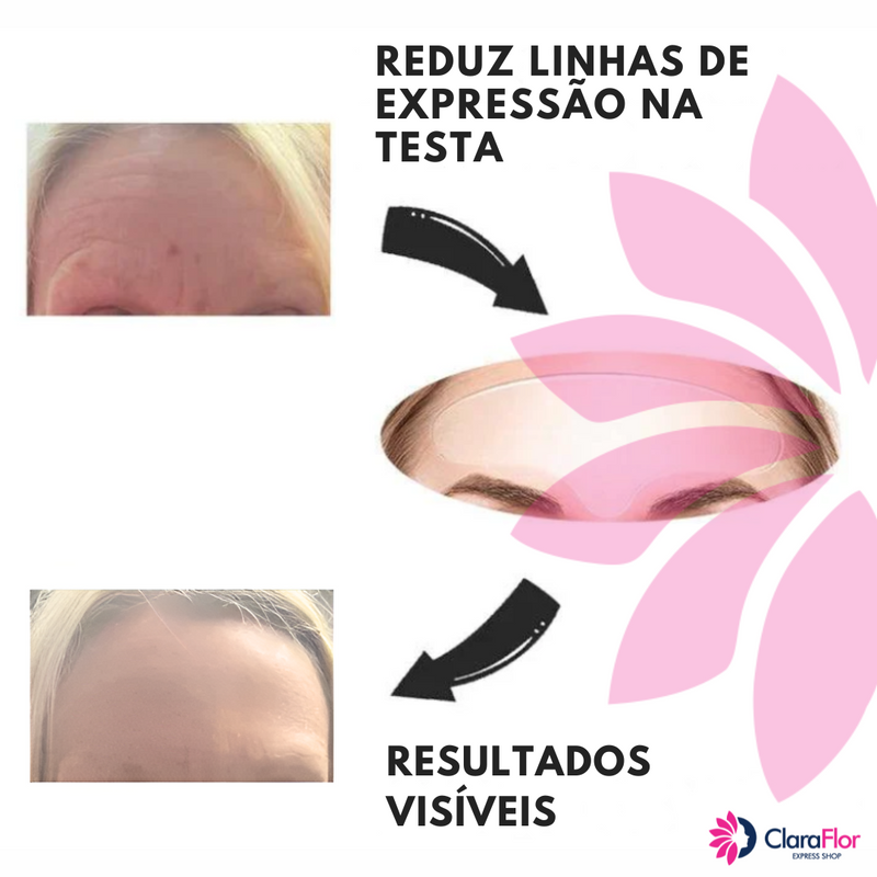 Nature Skin Lift - O adesivo Antissinais e Linhas de Expressão. Kit com 11 Adesivos reutilizáveis anti-envelhecimento. Nature é um In-home Botox, Super Econômico porque você pode reutilizá-lo por até 40 vezes.