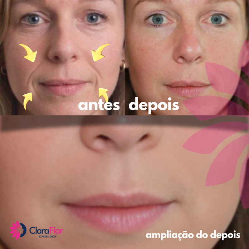 Nature Skin Lift - O adesivo Antissinais e Linhas de Expressão. Kit com 11 Adesivos reutilizáveis anti-envelhecimento. Nature é um In-home Botox, Super Econômico porque você pode reutilizá-lo por até 40 vezes.